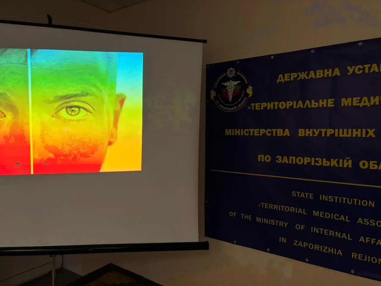 Зображення для новини Обережно - вірусні гепатити!