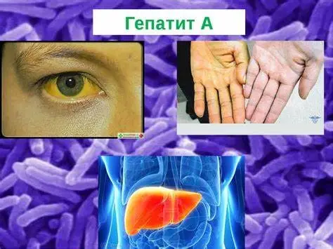 Зображення для новини Інформація по Гепатиту А
