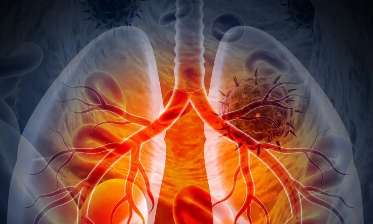 Зображення для новини Туберкульоз : Чому важливо вчасно звернутися до лікаря?