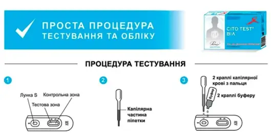 Зображення для новини Аналіз на ВІЛ: як перевірити свій статус?