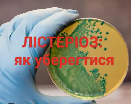 Зображення для новини Лістеріоз: як захистити себе та зберегти здоров’я
