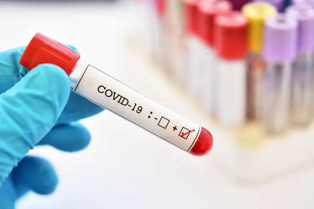 Зображення для новини Обережно, COVID-19