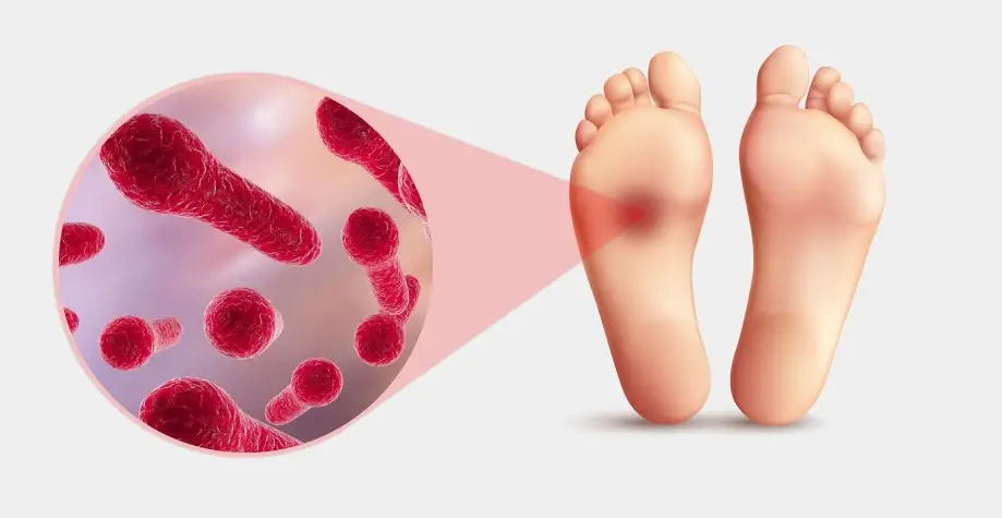 Зображення для новини Смерть дитини від правця на Дніпропетровщині. Перші симптоми та як запобігти хворобі.